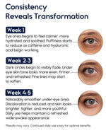 Revitalize Your Eyes: Powerful Under Eye Cream for Puffiness, Dark Circles & Wrinkles - 1 Fl Oz Treatment for Men & Women with Retinol, Hyaluronic Acid & Caffeine