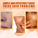 Revitalize Your Skin with Our Vitamin C Moisturizing Spray - Hydrate, Lighten Acne Spots, and Achieve a Radiant Glow