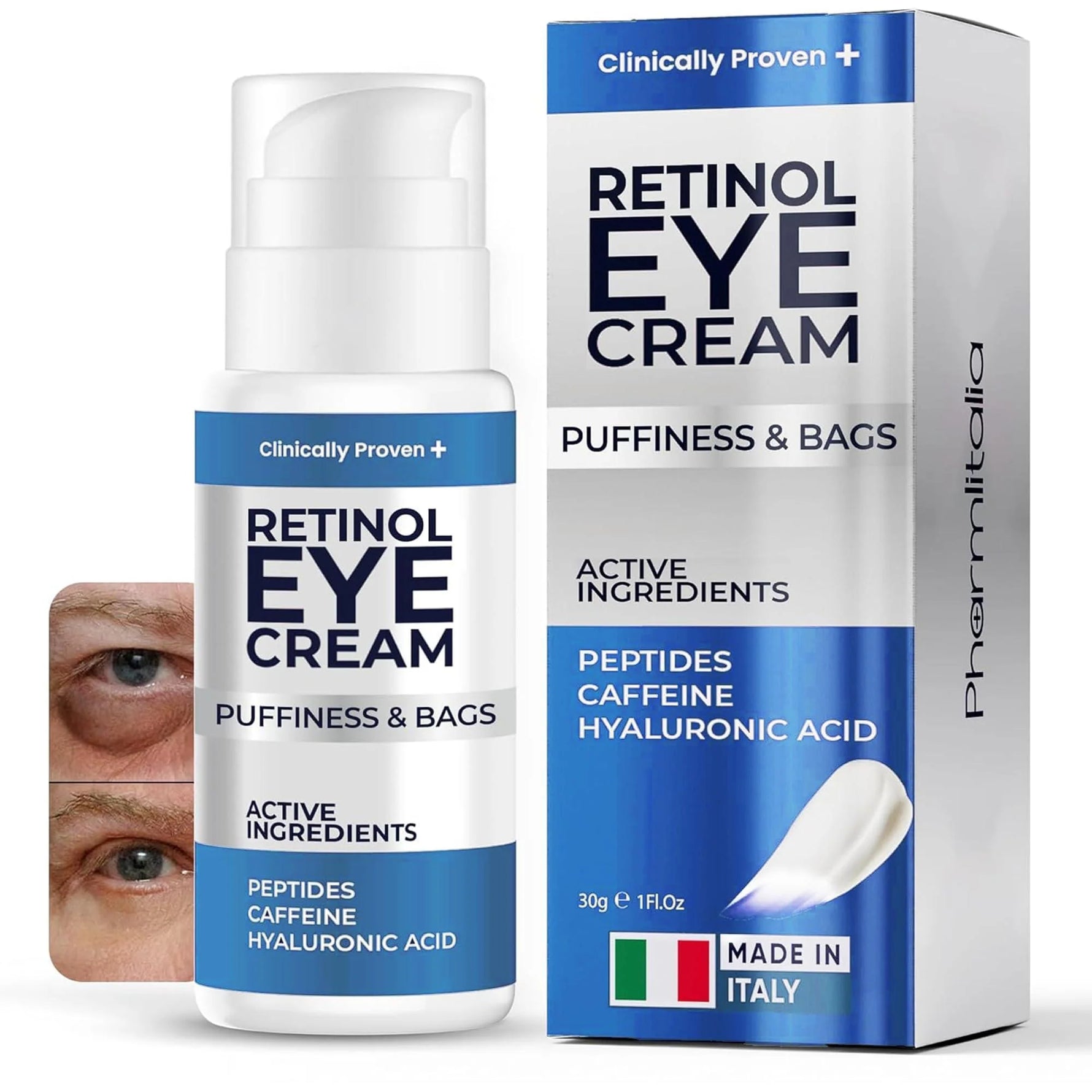Revitalize Your Eyes: Powerful Under Eye Cream for Puffiness, Dark Circles & Wrinkles - 1 Fl Oz Treatment for Men & Women with Retinol, Hyaluronic Acid & Caffeine