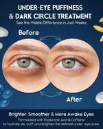Revitalize Your Eyes: Powerful Under Eye Cream for Puffiness, Dark Circles & Wrinkles - 1 Fl Oz Treatment for Men & Women with Retinol, Hyaluronic Acid & Caffeine
