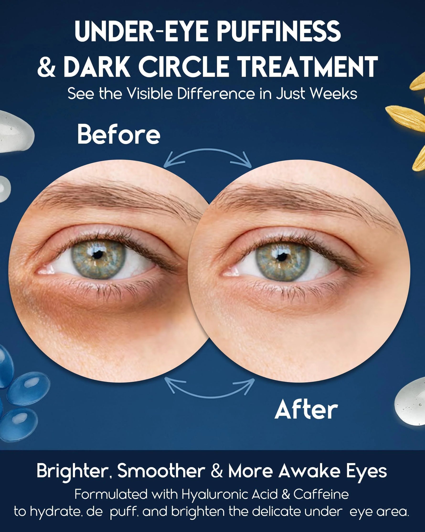 Revitalize Your Eyes: Powerful Under Eye Cream for Puffiness, Dark Circles & Wrinkles - 1 Fl Oz Treatment for Men & Women with Retinol, Hyaluronic Acid & Caffeine