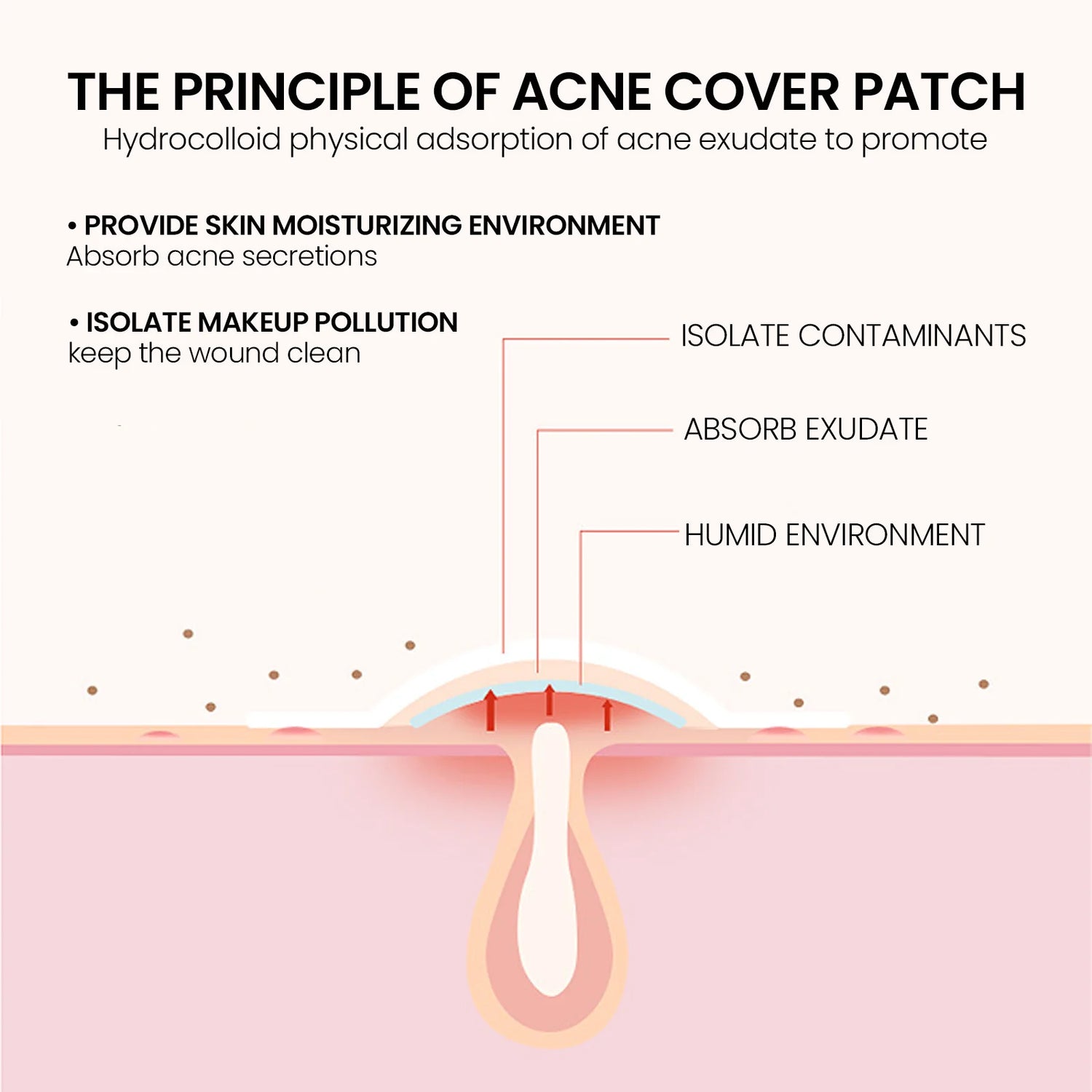 Ultimate Repair Acne Patch - 200 Patches for Clearer Skin
