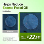 Revitalize Your Complexion with Our Azelaic Acid 10% & Hyaluronic Acid Redness Relief Serum - Lightweight Hydration for Blemish-Prone & Oily Skin, 1.01 Fl Oz