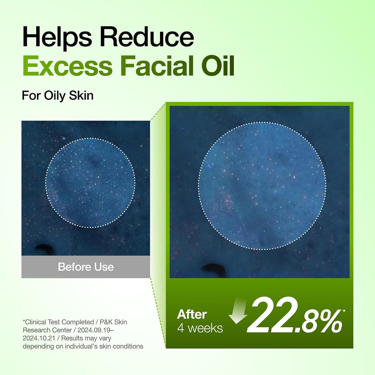 Revitalize Your Complexion with Our Azelaic Acid 10% & Hyaluronic Acid Redness Relief Serum - Lightweight Hydration for Blemish-Prone & Oily Skin, 1.01 Fl Oz