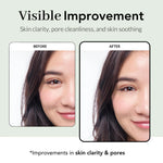 Revitalize Your Skin with Our Tea Tree Wrapping Mask - Soothing Care for Acne-Prone Skin with Tropical Fruit Extracts
