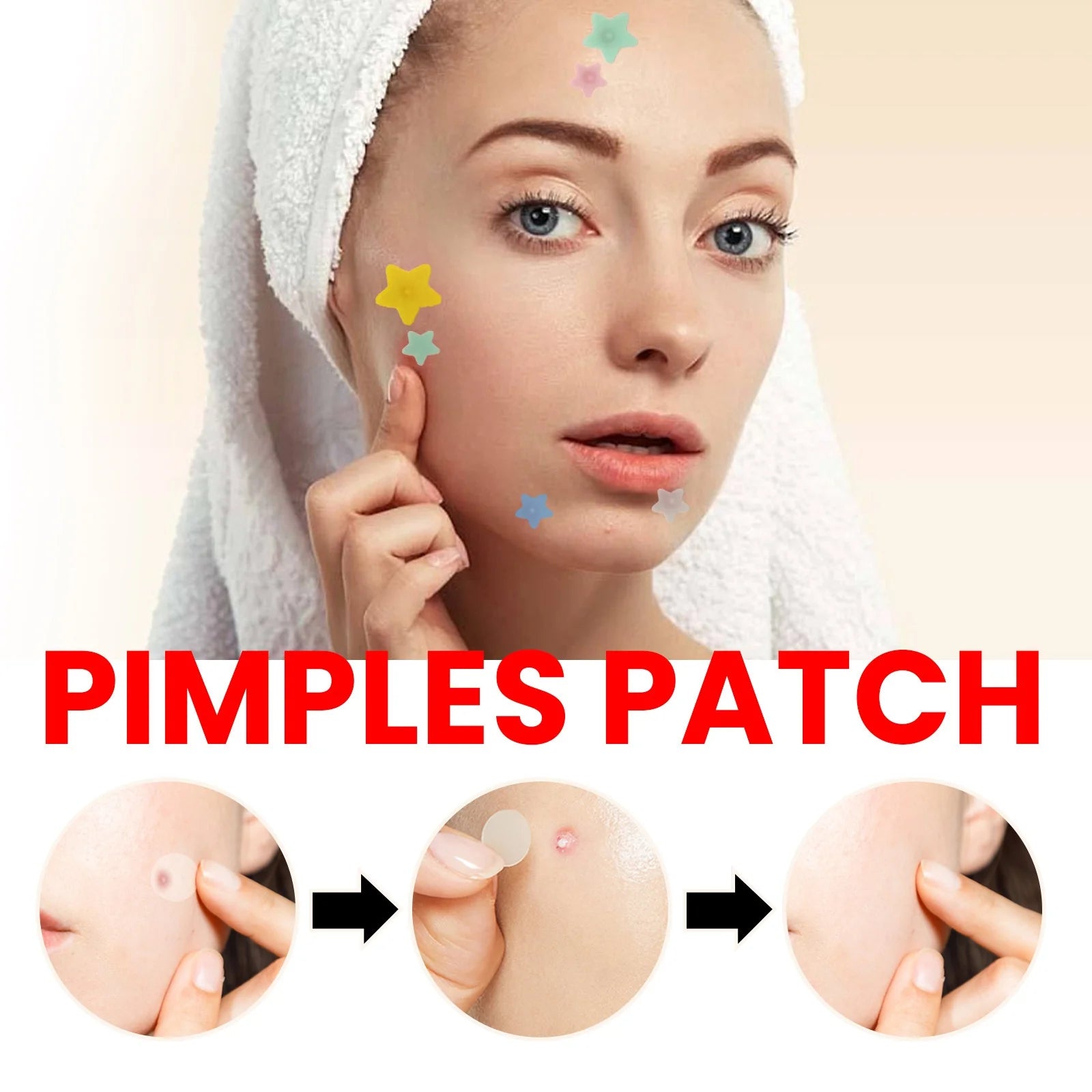Ultimate Repair Acne Patch - 200 Patches for Clearer Skin
