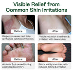 Revitalize Your Skin Anywhere: Cleansing Body Wipes with Tea Tree Oil - 40 Pack for Athletes, Gym Goers, and Outdoor Adventures