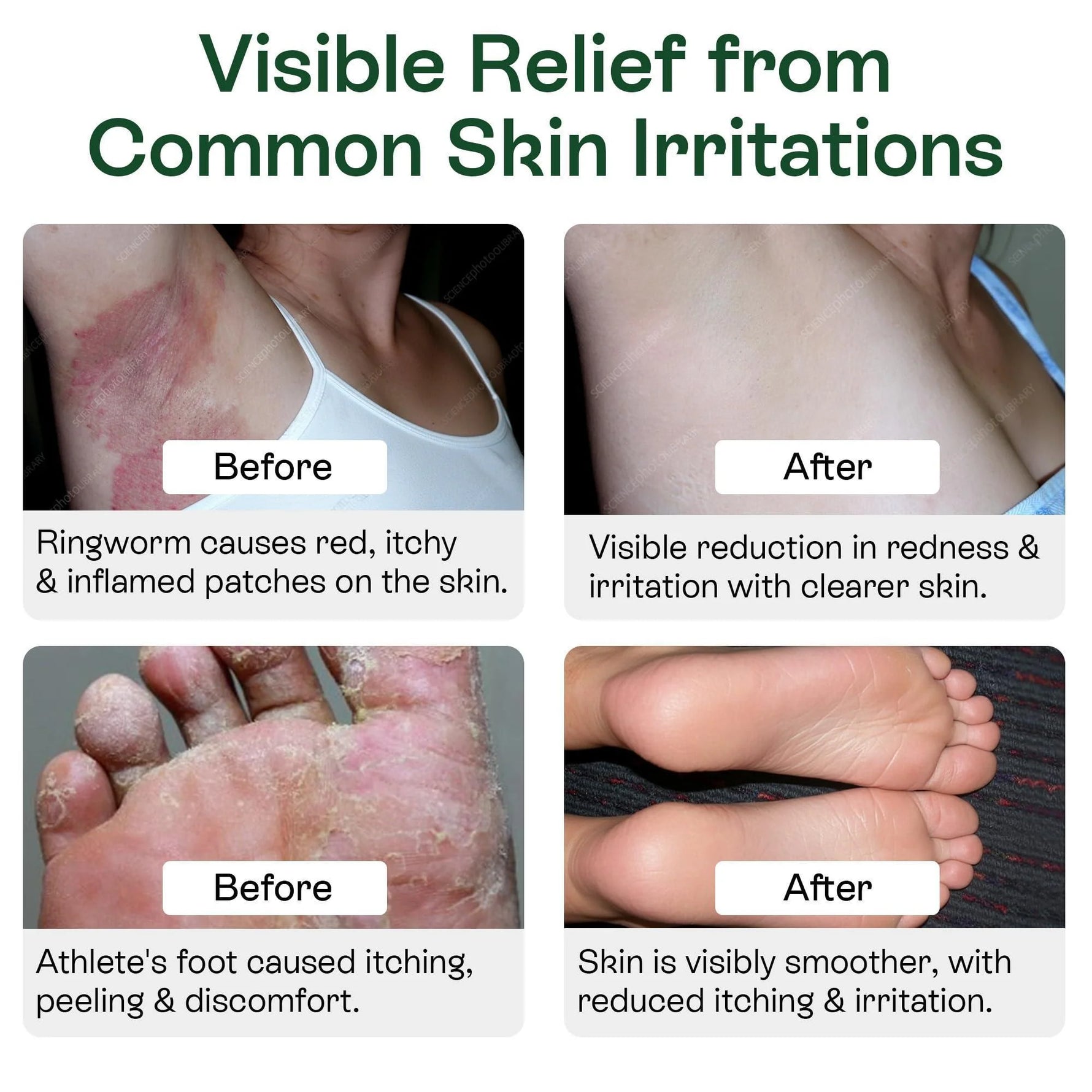 Revitalize Your Skin Anywhere: Cleansing Body Wipes with Tea Tree Oil - 40 Pack for Athletes, Gym Goers, and Outdoor Adventures